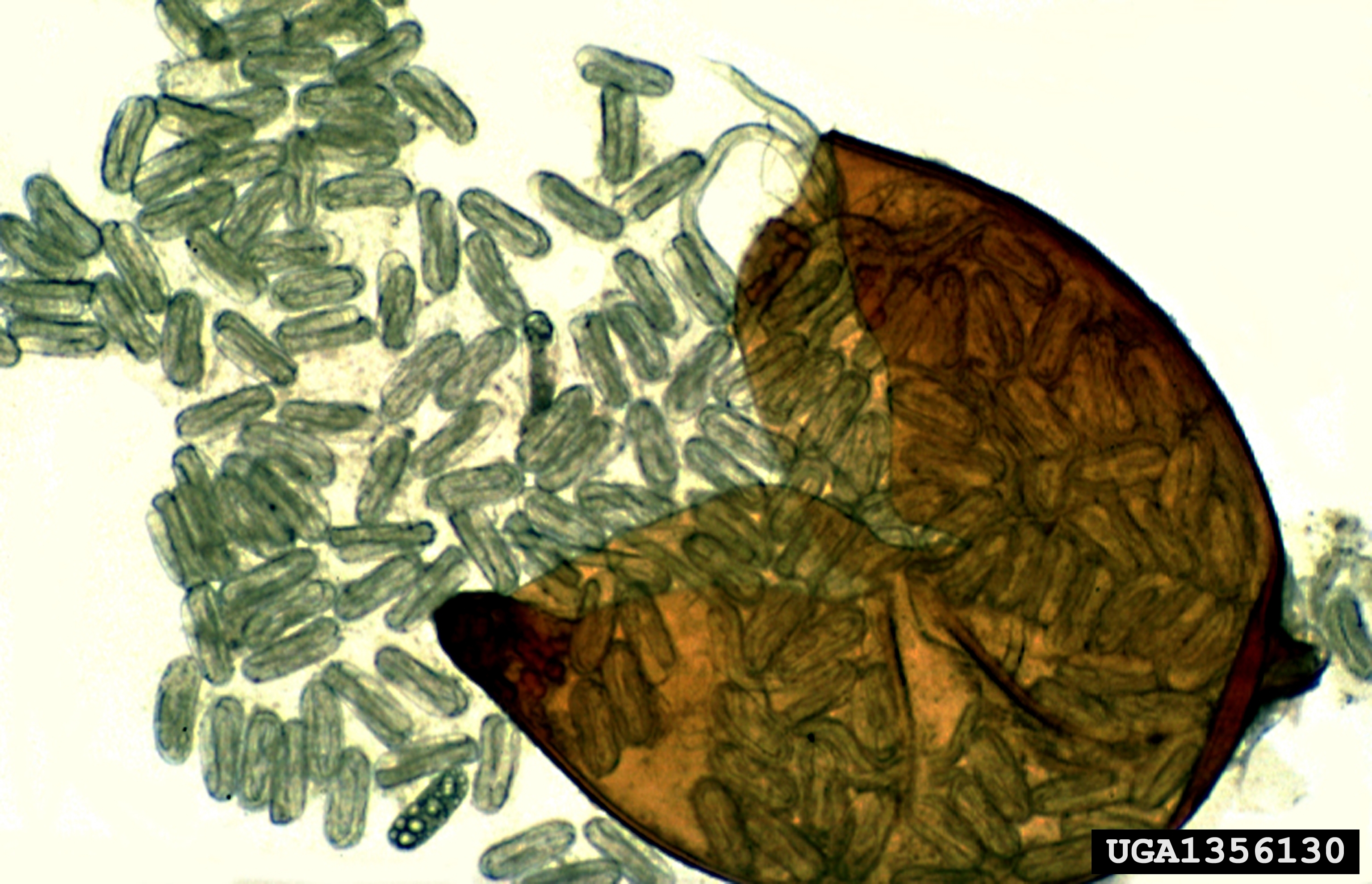 A crushed cyst of Globodera rostochiensis with numerous eggs.